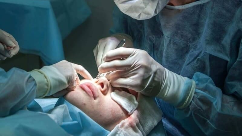 Person undergoing refractive surgery at Newport Beach